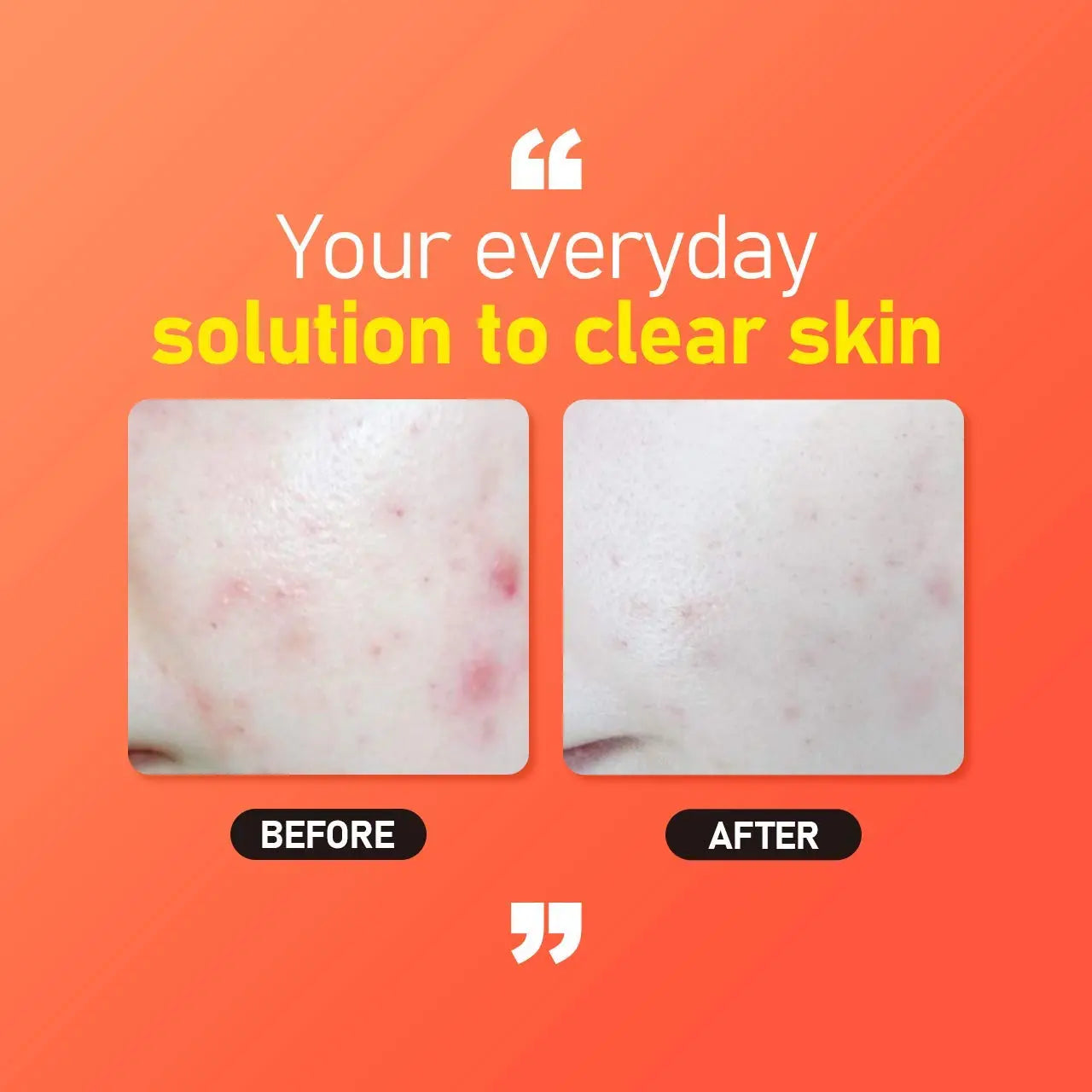 [Jumiso] All Day Brightening Serum 40ML Wepremiumng